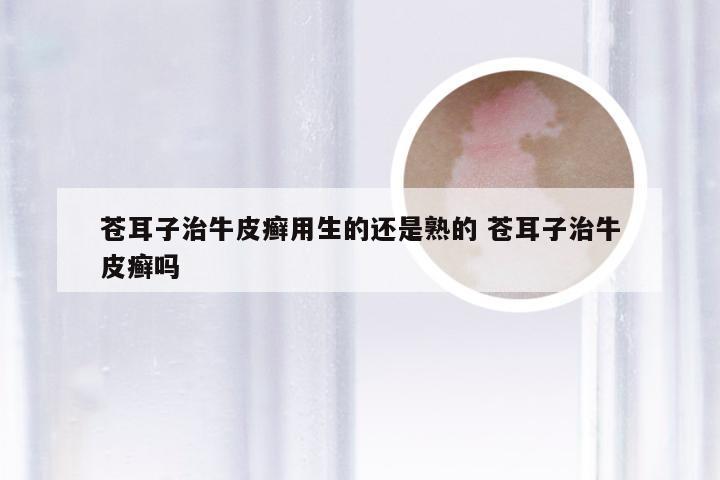 苍耳子治牛皮癣用生的还是熟的 苍耳子治牛皮癣吗