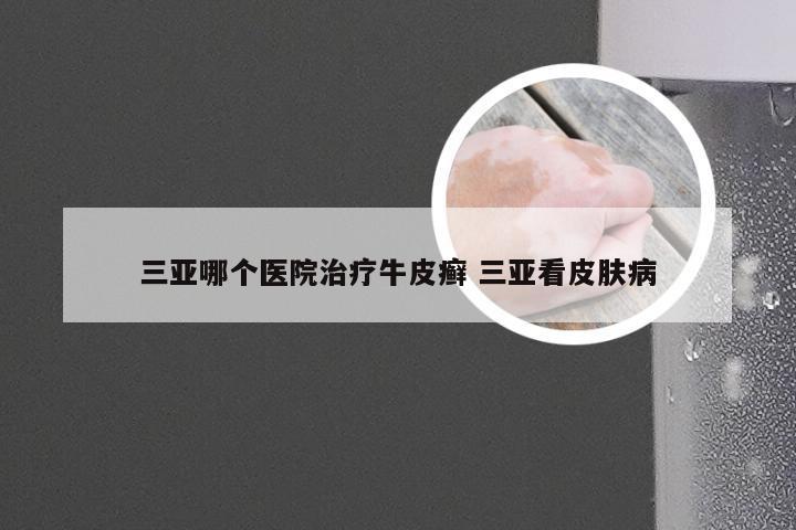 三亚哪个医院治疗牛皮癣 三亚看皮肤病