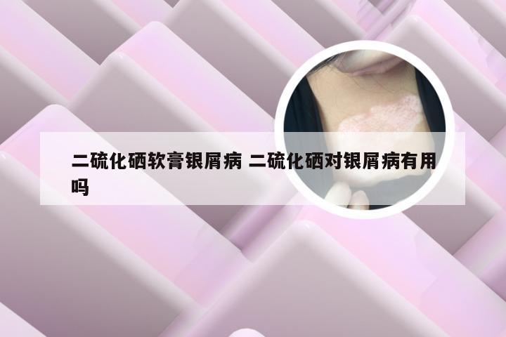 二硫化硒软膏银屑病 二硫化硒对银屑病有用吗