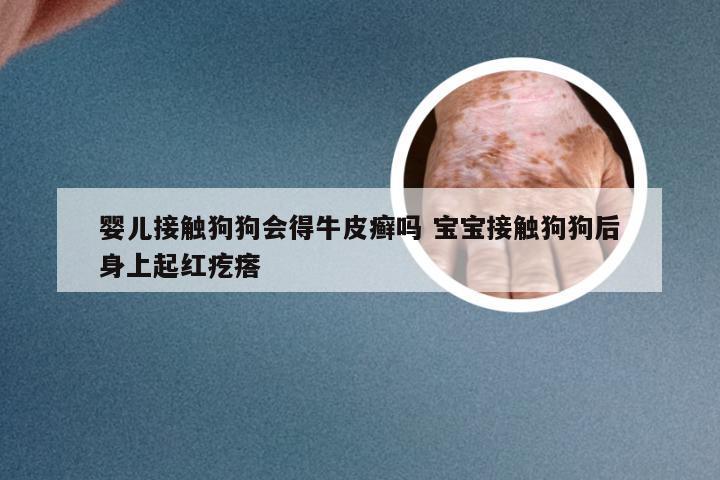 婴儿接触狗狗会得牛皮癣吗 宝宝接触狗狗后身上起红疙瘩