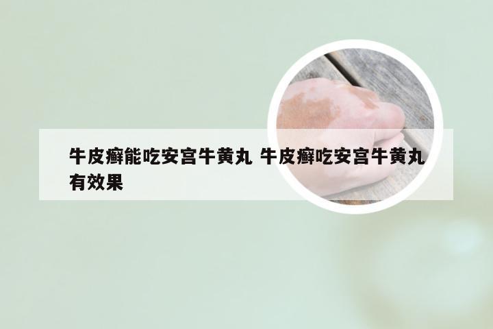 牛皮癣能吃安宫牛黄丸 牛皮癣吃安宫牛黄丸有效果
