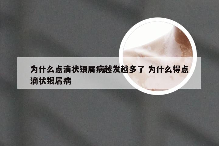 为什么点滴状银屑病越发越多了 为什么得点滴状银屑病