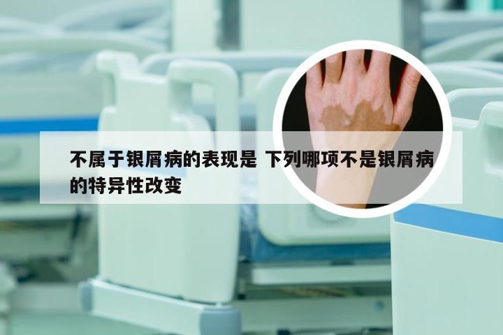 不属于银屑病的表现是 下列哪项不是银屑病的特异性改变