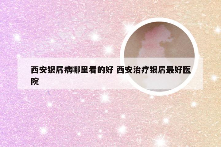 西安银屑病哪里看的好 西安治疗银屑最好医院