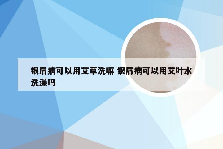 银屑病可以用艾草洗嘛 银屑病可以用艾叶水洗澡吗