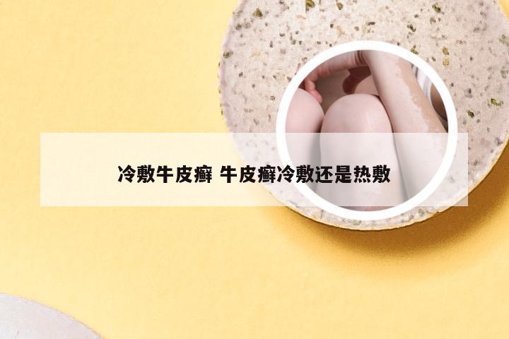 冷敷牛皮癣 牛皮癣冷敷还是热敷