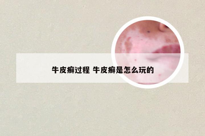 牛皮癣过程 牛皮癣是怎么玩的