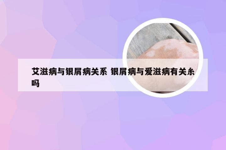 艾滋病与银屑病关系 银屑病与爱滋病有关糸吗