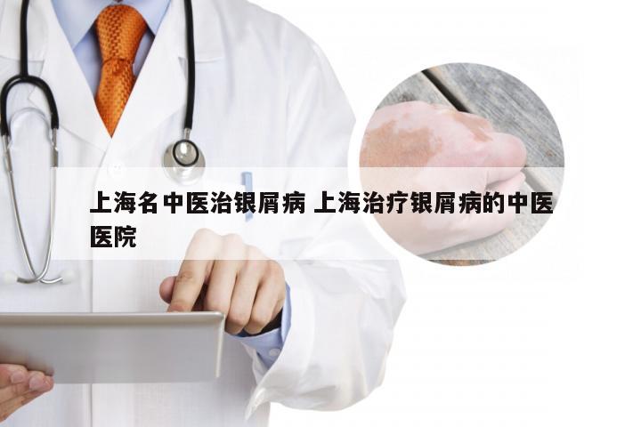 上海名中医治银屑病 上海治疗银屑病的中医医院