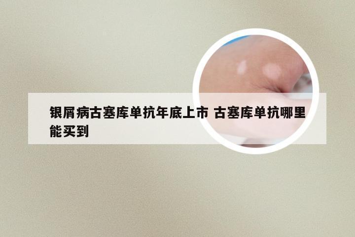 银屑病古塞库单抗年底上市 古塞库单抗哪里能买到