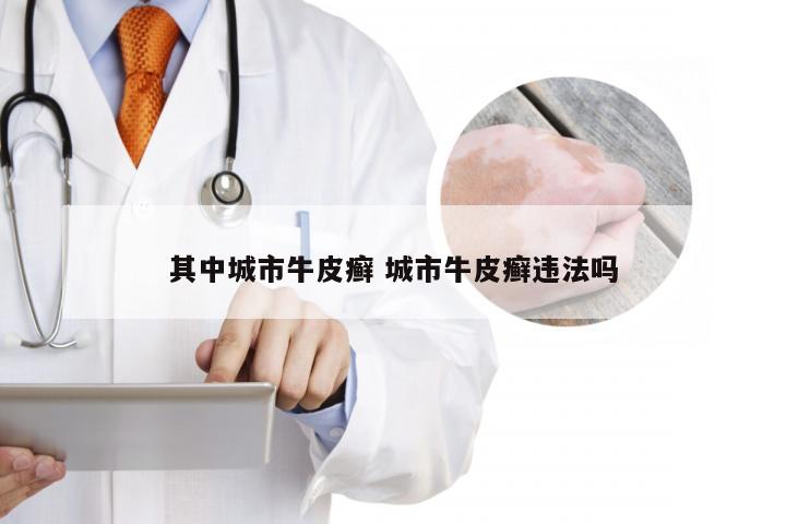 其中城市牛皮癣 城市牛皮癣违法吗