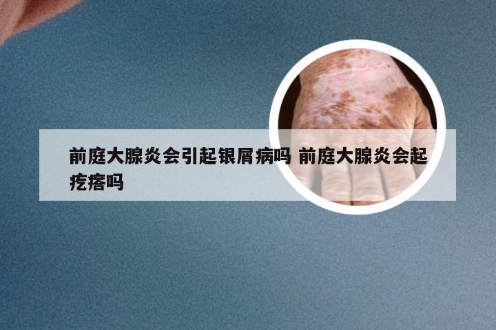 前庭大腺炎会引起银屑病吗 前庭大腺炎会起疙瘩吗