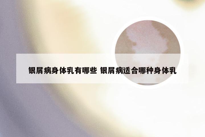 银屑病身体乳有哪些 银屑病适合哪种身体乳