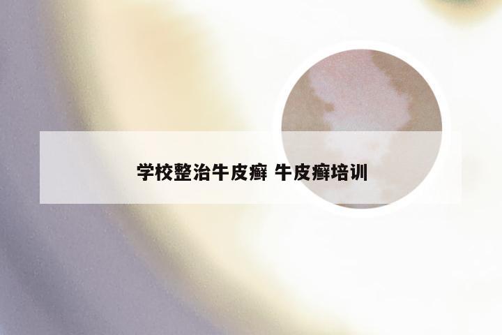 学校整治牛皮癣 牛皮癣培训