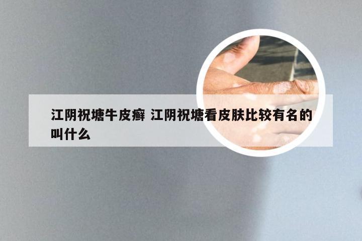 江阴祝塘牛皮癣 江阴祝塘看皮肤比较有名的叫什么