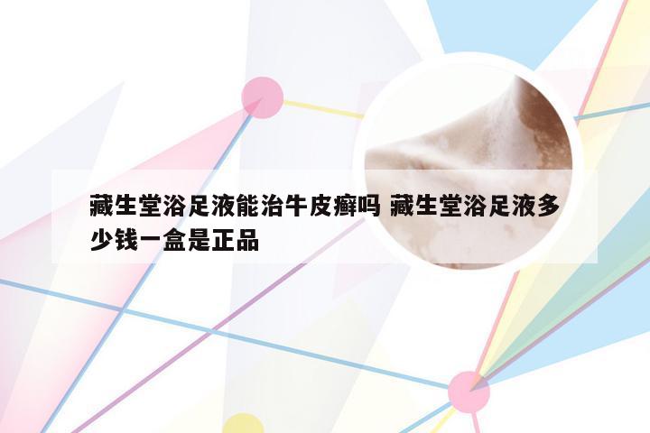 藏生堂浴足液能治牛皮癣吗 藏生堂浴足液多少钱一盒是正品