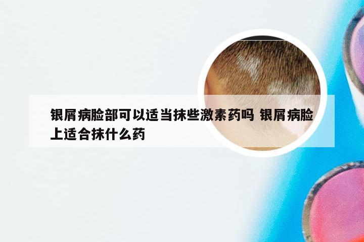 银屑病脸部可以适当抹些激素药吗 银屑病脸上适合抹什么药