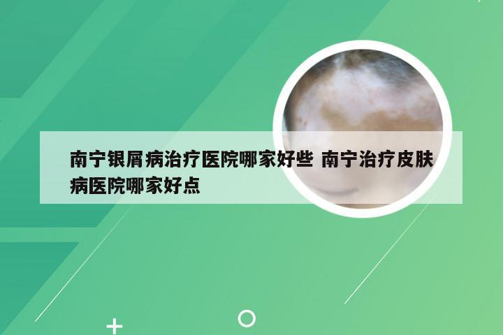 南宁银屑病治疗医院哪家好些 南宁治疗皮肤病医院哪家好点