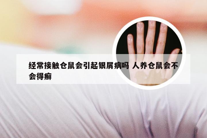 经常接触仓鼠会引起银屑病吗 人养仓鼠会不会得癣