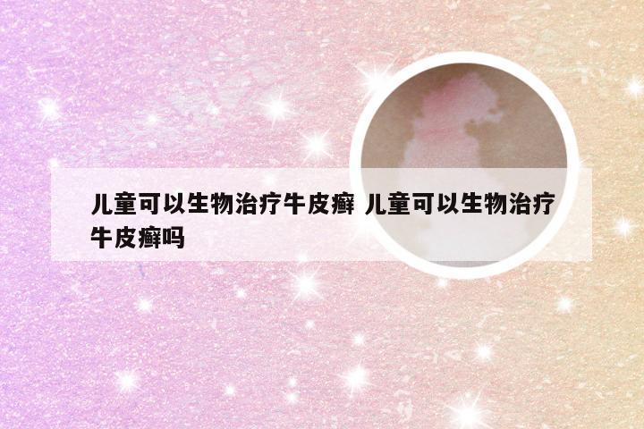 儿童可以生物治疗牛皮癣 儿童可以生物治疗牛皮癣吗