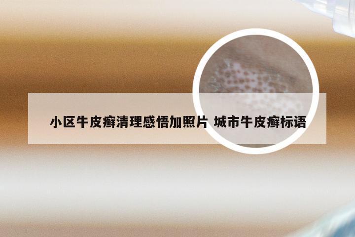小区牛皮癣清理感悟加照片 城市牛皮癣标语
