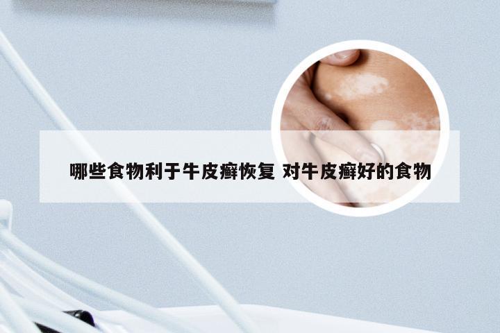哪些食物利于牛皮癣恢复 对牛皮癣好的食物