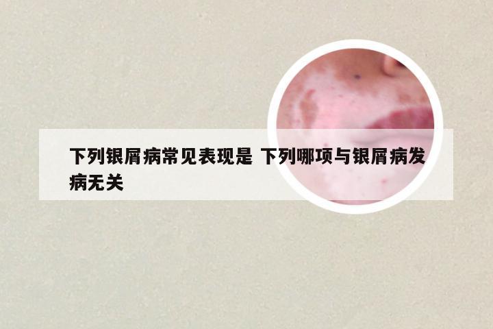下列银屑病常见表现是 下列哪项与银屑病发病无关