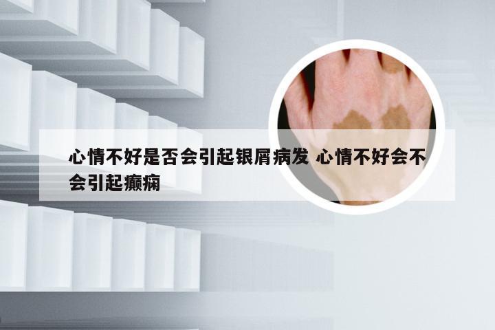 心情不好是否会引起银屑病发 心情不好会不会引起癫痫