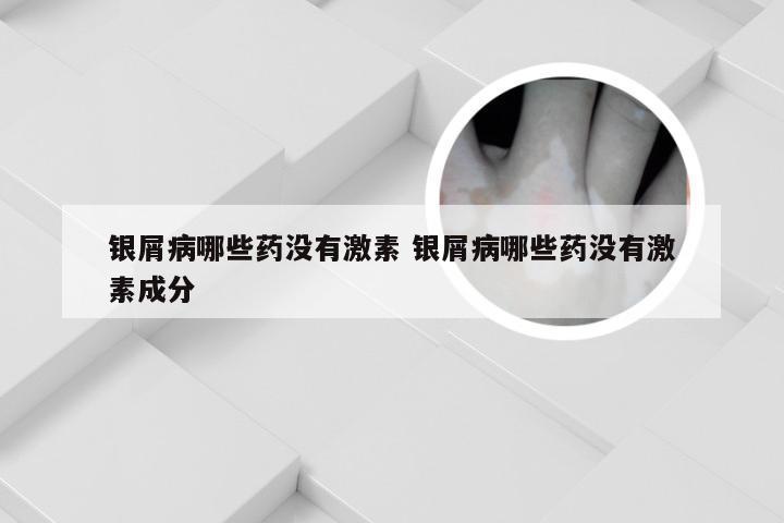 银屑病哪些药没有激素 银屑病哪些药没有激素成分
