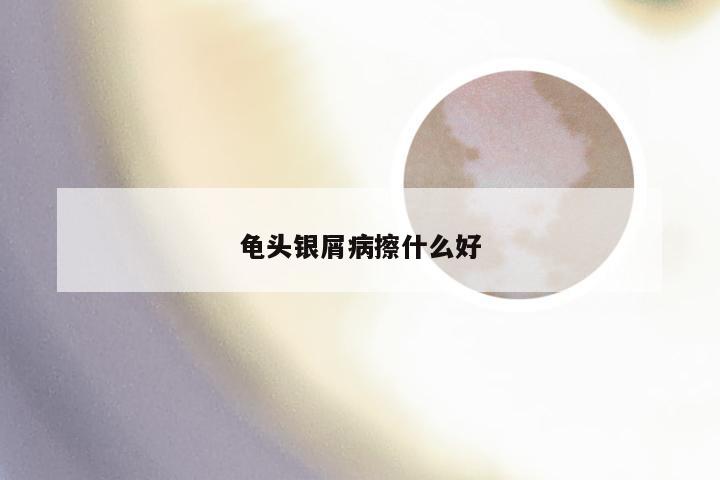 龟头银屑病擦什么好