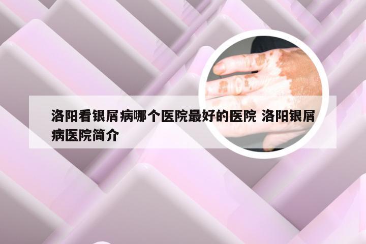 洛阳看银屑病哪个医院最好的医院 洛阳银屑病医院简介