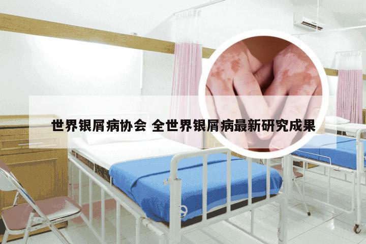 世界银屑病协会 全世界银屑病最新研究成果