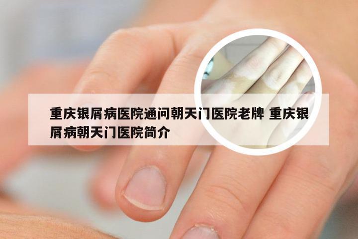重庆银屑病医院通问朝天门医院老牌 重庆银屑病朝天门医院简介