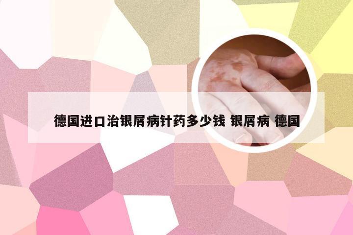 德国进口治银屑病针药多少钱 银屑病 德国