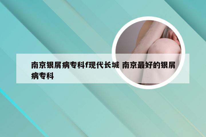 南京银屑病专科f现代长城 南京最好的银屑病专科
