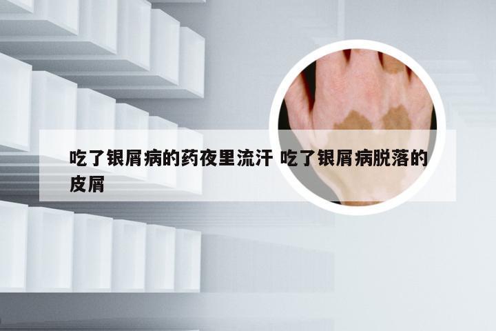 吃了银屑病的药夜里流汗 吃了银屑病脱落的皮屑