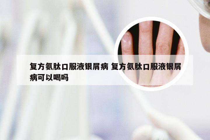 复方氨肽口服液银屑病 复方氨肽口服液银屑病可以喝吗