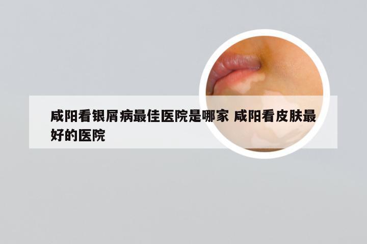 咸阳看银屑病最佳医院是哪家 咸阳看皮肤最好的医院