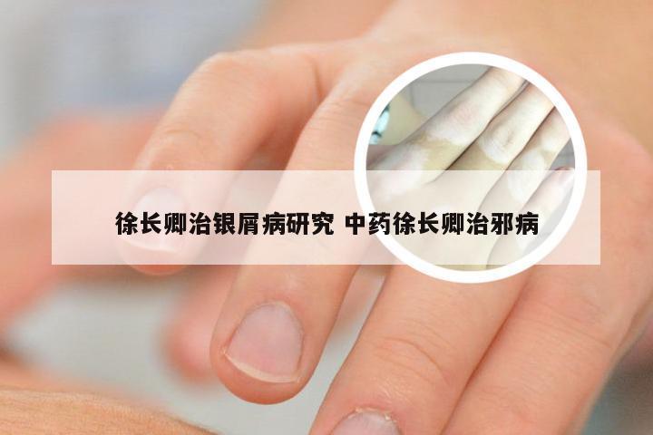 徐长卿治银屑病研究 中药徐长卿治邪病