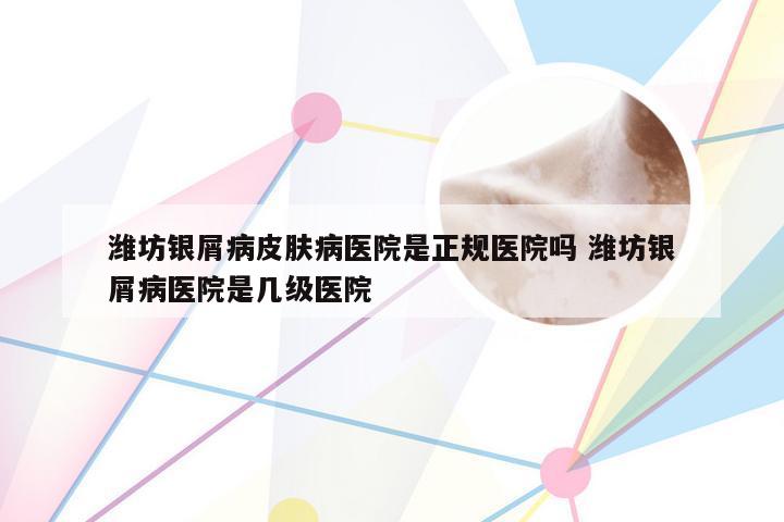 潍坊银屑病皮肤病医院是正规医院吗 潍坊银屑病医院是几级医院