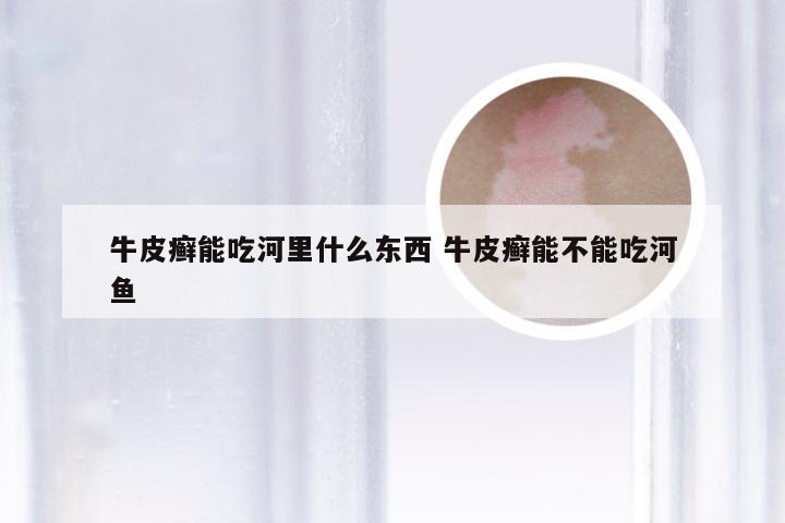 牛皮癣能吃河里什么东西 牛皮癣能不能吃河鱼