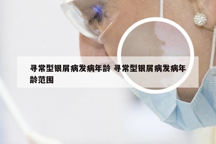 寻常型银屑病发病年龄 寻常型银屑病发病年龄范围