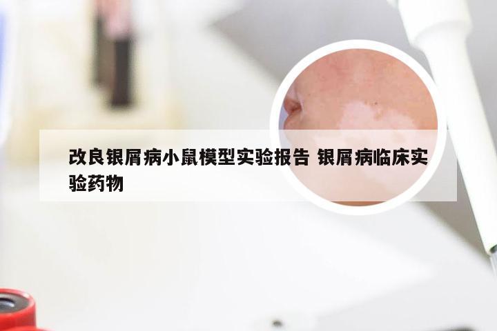 改良银屑病小鼠模型实验报告 银屑病临床实验药物
