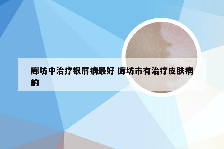 廊坊中治疗银屑病最好 廊坊市有治疗皮肤病的
