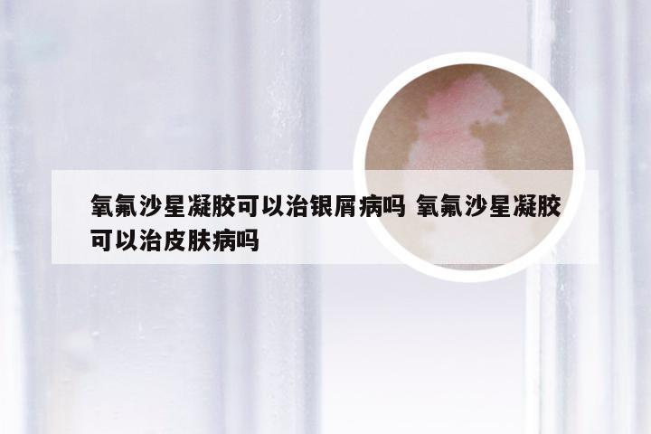 氧氟沙星凝胶可以治银屑病吗 氧氟沙星凝胶可以治皮肤病吗