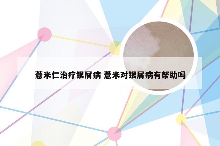 薏米仁治疗银屑病 薏米对银屑病有帮助吗