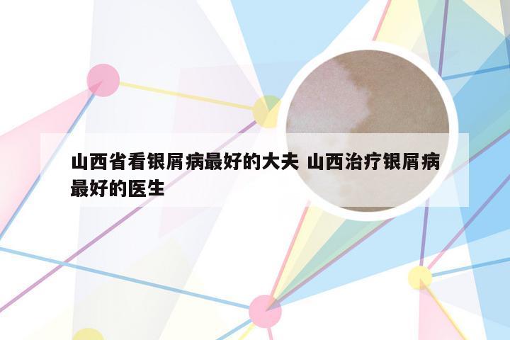 山西省看银屑病最好的大夫 山西治疗银屑病最好的医生