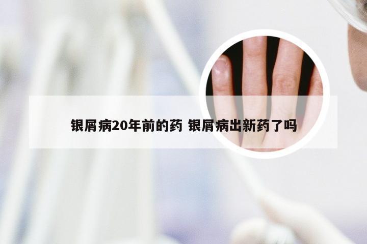 银屑病20年前的药 银屑病出新药了吗
