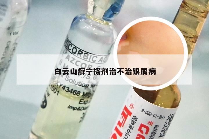 白云山癣宁搽剂治不治银屑病