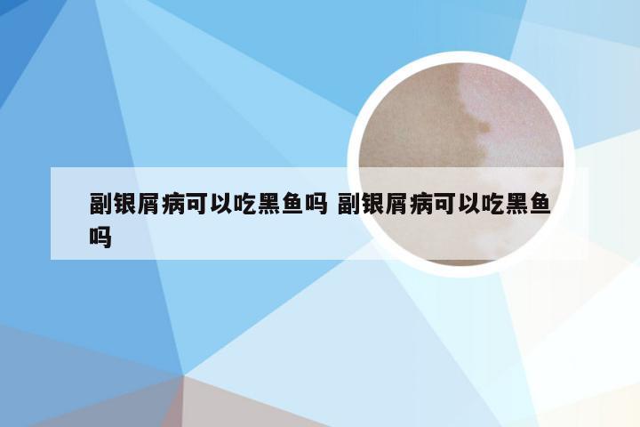 副银屑病可以吃黑鱼吗 副银屑病可以吃黑鱼吗